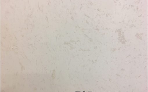 1118 SL Stoneworks All natural white Quartz countertop